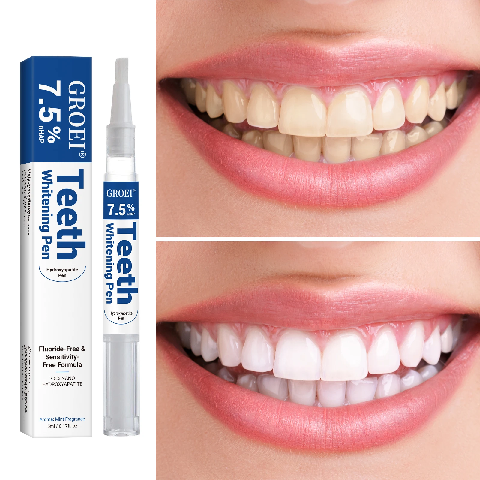 Гидроксипатитовая ручка для от – обзор и цена Teeth Whitening Pens